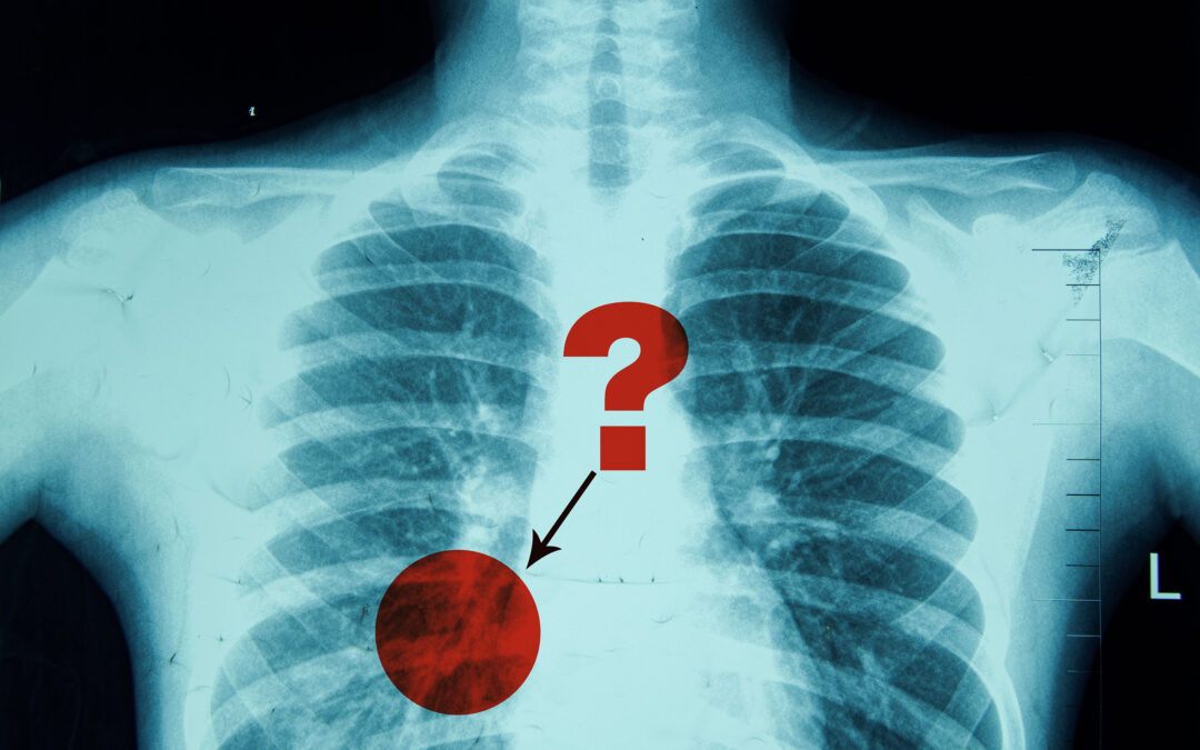New method evaluates and improves the reliability of radiologists’ diagnostic reports | MIT News