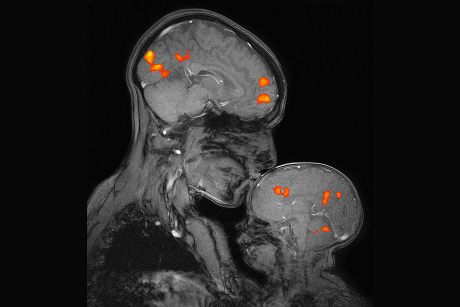 MIT’s McGovern School is Shaping Brain Science and Improving Human Life Globally | MIT News