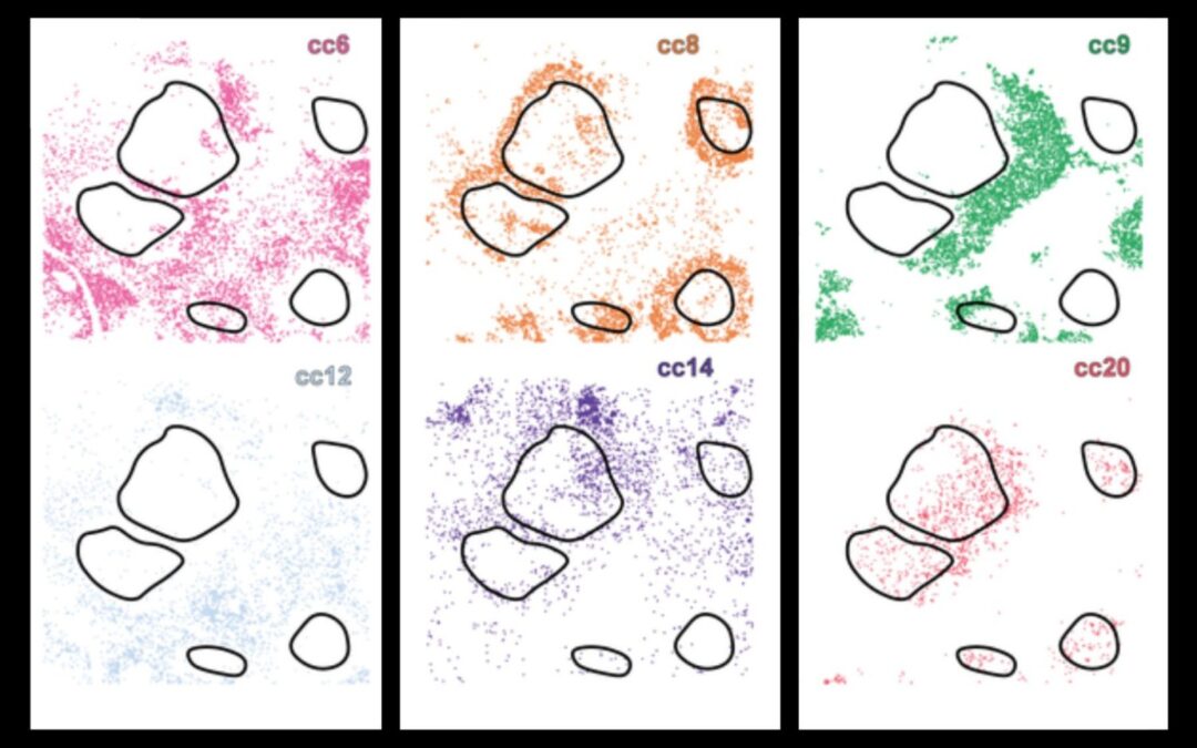 New AI system reveals hidden cell subtypes, enhanced precision drugs | MIT News